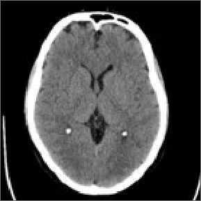 CT scan of head.