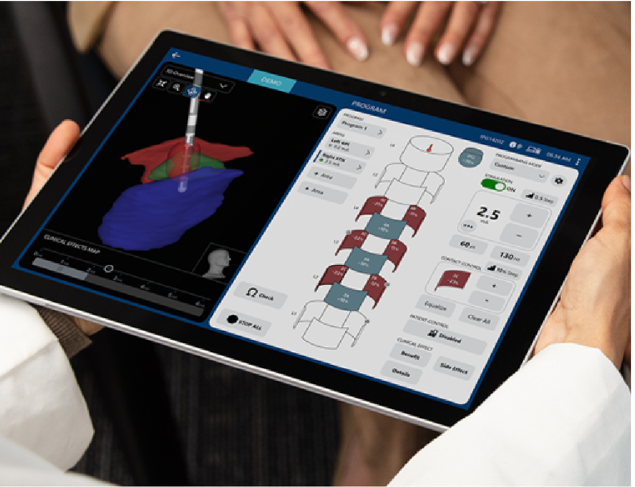 Image guided programming on tablet.