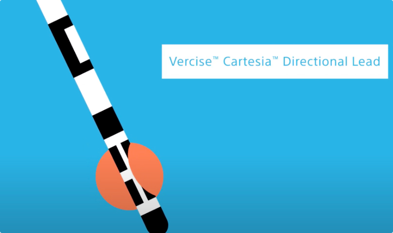 Play video of how Directional DBS targets your PD symptoms